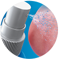 Spray