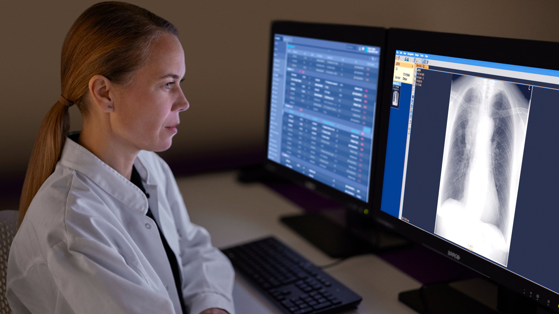 Lung cancer screening made smarter &ndash; Combining Leading Technology and AI