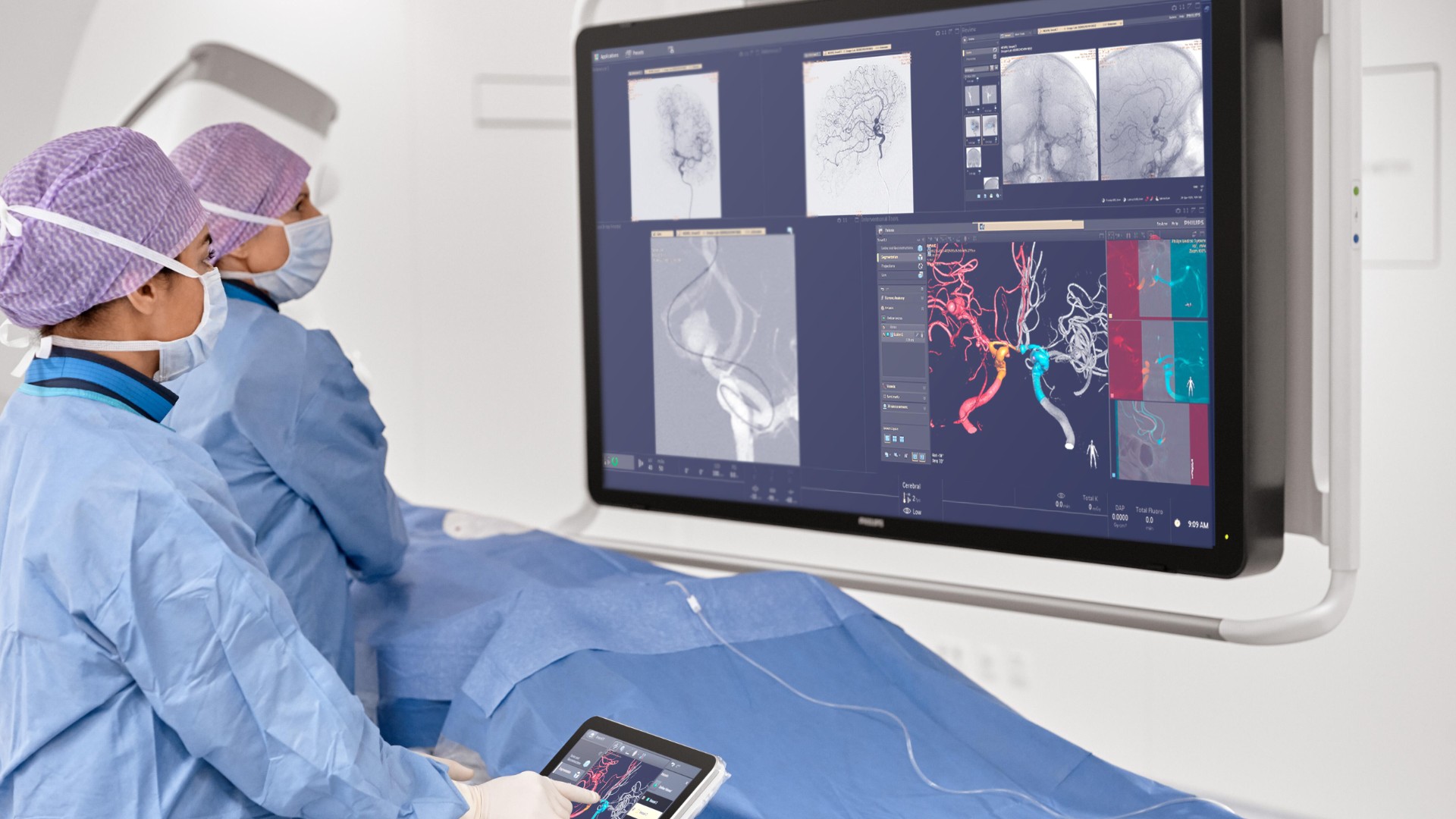Philips launches intelligent 3D imaging in Europe to empower faster stroke care, helping physicians save time, brain, and lives